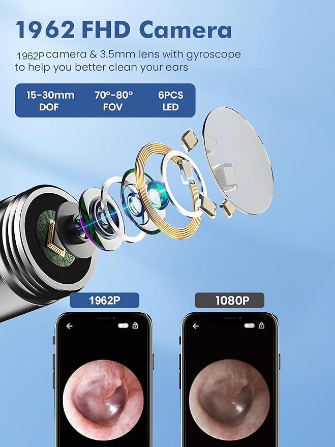 Wireless HD Ear Cleaning Camera Kit